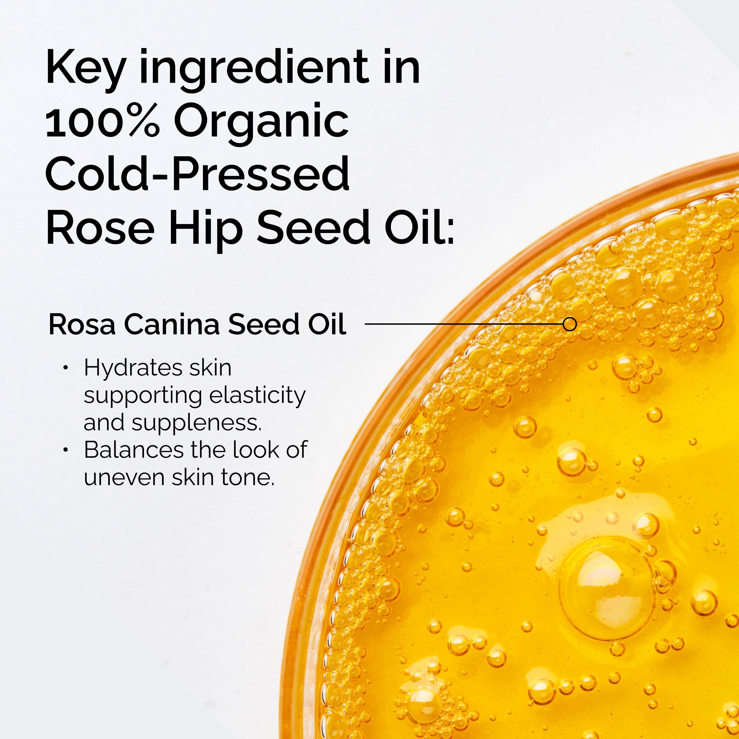 Get Radiant Skin with Organic Cold-Pressed Rose Hip Seed Oil 30ml - Image 3